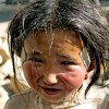 Tibetan girl with bandaids