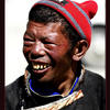 Photo of Tibetan man in Tingri in need of dental care on ExposedPlanet.com