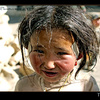 Tibetan girl with bandaids